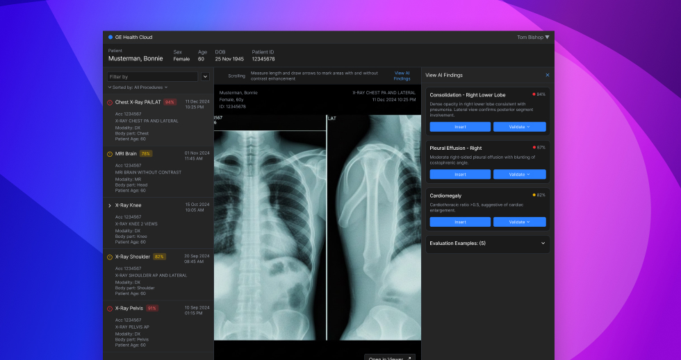 GE Healthcare